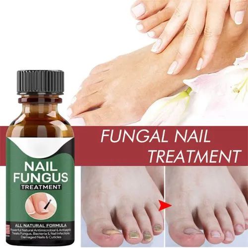 Fast Nail Fungal Treatment Gel – Repair & Care for Healthy Nails